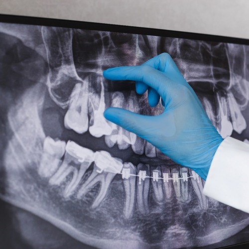 dentist taking a close look at a dental X-ray 