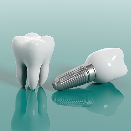 Animated tooth and implant replacement tooth compared