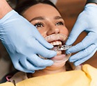 Dentist placing clear aligner on smiling patient