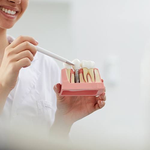 Female dental patient smiling after getting dental implants in Midlothian, TX