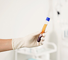 a person holding a tube used for PRP/PRF treatment