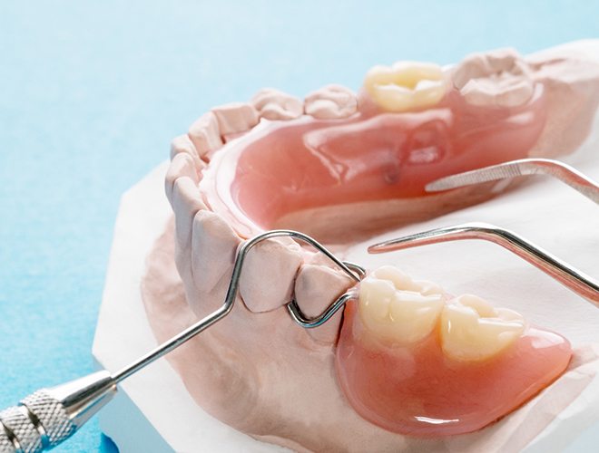 Closeup of partial dentures