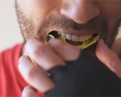 A mouthguard, a form of dental implant care in Midlothian