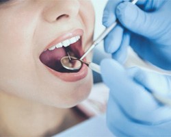 : A dental checkup, a form of dental implant care in Midlothian