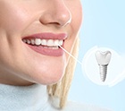 person smiling with dental implant 