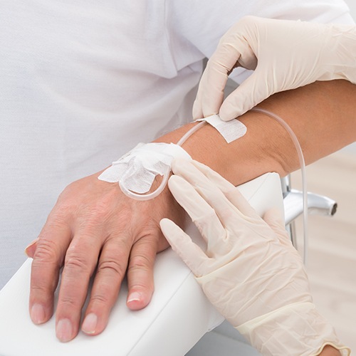 Patient receiving IV sedation