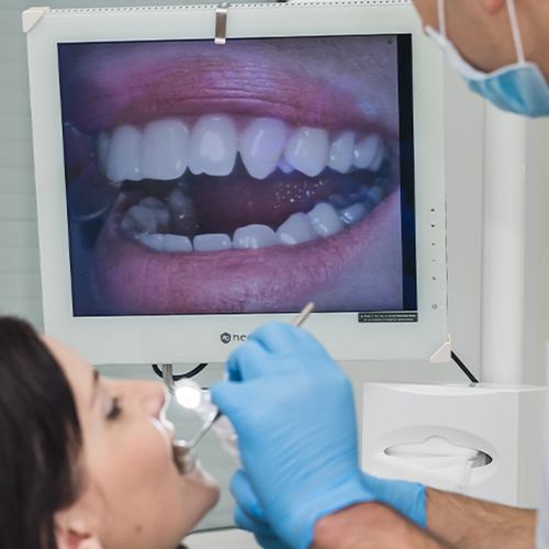 Dentist and patient looking ant intraoral smile images
