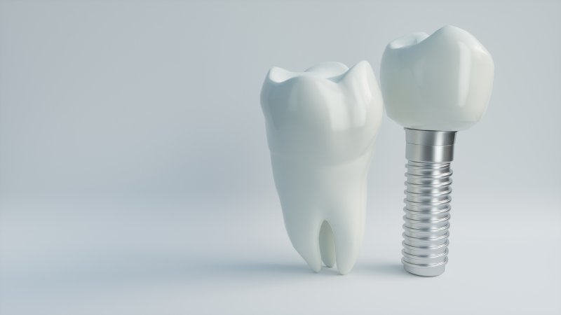dental implants next to a complete tooth